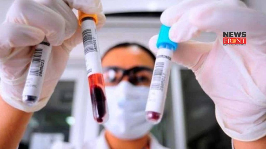 blood test | newsfront.co